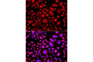 Immunofluorescence analysis of A549 cell using PRKAG3 antibody. (PRKAG3 Antikörper)