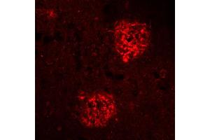 Immunohistochemistry (IHC) image for anti-Amyloid beta 1-40 (Abeta 1-40) (AA 33-40) antibody (ABIN1742442) (Abeta 1-40 Antikörper  (AA 33-40))