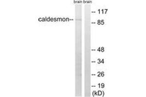 Western Blotting (WB) image for anti-Caldesmon 1 (CALD1) (AA 725-774) antibody (ABIN2889143) (Caldesmon Antikörper  (AA 725-774))