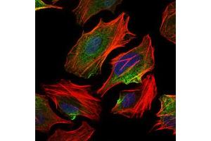 Image no. 7 for anti-ATP Citrate Lyase (ACLY) antibody (ABIN1491378) (ACLY Antikörper)