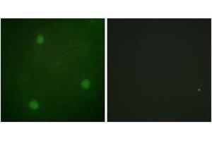 Immunofluorescence analysis of NIH-3T3 cells, using Artemis (Ab-516) Antibody. (DCLRE1C Antikörper  (AA 482-531))