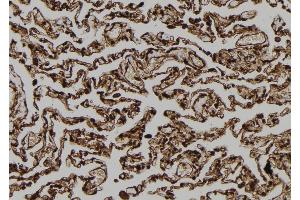 ABIN6273116 at 1/100 staining Human lung tissue by IHC-P.