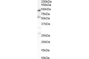 Image no. 1 for anti-Oxysterol Binding Protein-Like 10 (OSBPL10) (Internal Region) antibody (ABIN374621) (OSBPL10 Antikörper  (Internal Region))