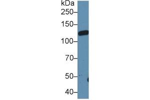 Western blot analysis of Rat Serum, using Rat LIFR Antibody (1 µg/ml) and HRP-conjugated Goat Anti-Rabbit antibody ( (LIFR Antikörper  (AA 152-291))