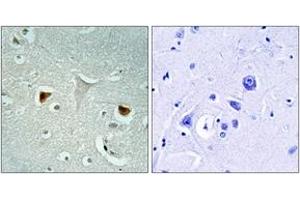 Immunohistochemistry analysis of paraffin-embedded human brain tissue, using STAT3 (Ab-727) Antibody. (STAT3 Antikörper  (AA 694-743))