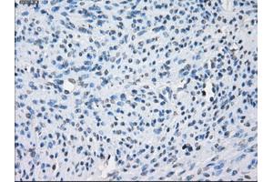 Immunohistochemical staining of paraffin-embedded colon tissue using anti-AURKCmouse monoclonal antibody. (Aurora Kinase C Antikörper)