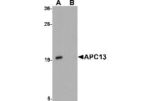 Western Blotting (WB) image for anti-Anaphase Promoting Complex Subunit 13 (ANAPC13) (Middle Region) antibody (ABIN1030860) (ANAPC13 Antikörper  (Middle Region))