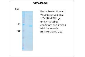 SDS-PAGE (SDS) image for Wnt1 Inducible Signaling Pathway Protein 3 (WISP3) (Active) protein (ABIN5509802)