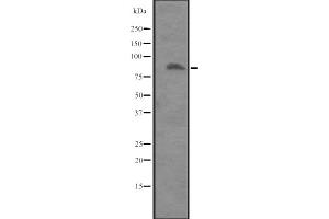 Western blot analysis of ITGB8 expression in Placenta lysate ,The lane on the left is treated with the antigen-specific peptide. (ITGB8 Antikörper  (Internal Region))