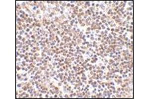 Immunohistochemistry of lipe in human lymph node tissue with this product at 2. (LIPE Antikörper  (C-Term))