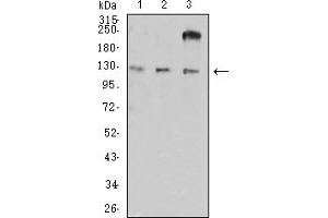 Western Blotting (WB) image for anti-Integrin alpha-L (ITGAL) (AA 26-194) antibody (ABIN7193238)