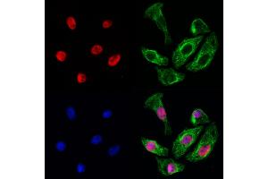 ABIN6260310 and ABIN6272938 staining Hela cells by IF/ICC. (BRD7 Antikörper  (Internal Region))