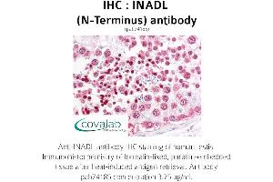 Image no. 1 for anti-InaD-Like (INADL) (N-Term) antibody (ABIN1735910)