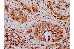 Immunohistochemistry (IHC) image for anti-SWI/SNF Related, Matrix Associated, Actin Dependent Regulator of Chromatin, Subfamily D, Member 2 (SMARCD2) (AA 1-113) antibody (ABIN7171075)