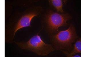 Immunofluorescence staining of methanol-fixed Hela cells using CDK6(phospho-Tyr13) Antibody. (CDK6 Antikörper  (pTyr13))