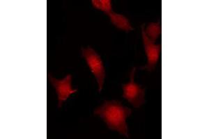 ABIN6267032 staining Hela by IF/ICC. (FER Antikörper  (C-Term))