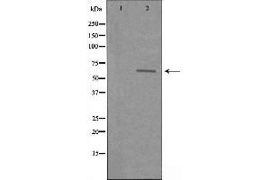 Western blot analysis of extracts from COLO cells using SLC22A3 antibody. (SLC22A3 Antikörper  (Internal Region))