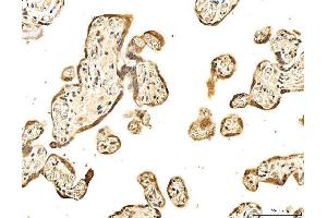 IHC analysis of 53BP1/TP53BP1 using anti-53BP1/TP53BP1 antibody (ABIN7599869). (TP53BP1 Antikörper  (AA 1239-1972))