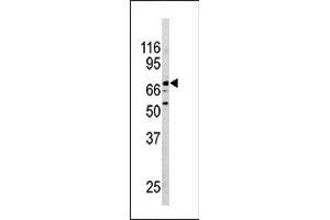 Western Blotting (WB) image for anti-Nuclear Receptor Subfamily 4, Group A, Member 2 (NR4A2) (AA 13-42), (N-Term) antibody (ABIN5537220)
