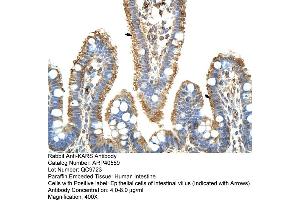 Rabbit Anti-KARS Antibody  Paraffin Embedded Tissue: Human Intestine Cellular Data: Epithelial cells of intestinal villas Antibody Concentration: 4. (KARS Antikörper  (C-Term))