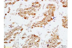 Formalin-fixed and rat intestine tissue labeled with Anti-NPY/Neuropeptide Y Polyclonal Antibody, Unconjugated  at 1:200 followed by conjugation to the secondary antibody and DAB staining (ECE1 Antikörper  (AA 665-770))