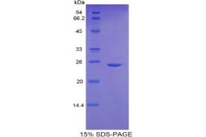 SDS-PAGE analysis of Mouse GCLC Protein.