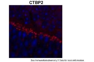 Sample Type: outer mouse plexiform layerRed: PrimaryBlue: DAPIPrimary Dilution: 1:200Secondary Antibody: Goat anti-Rabbit AF568 IgG(H+L)Secondary Dilution: 1:200Image Submitted by: David ZenisekYale University (CTBP2 Antikörper  (C-Term))