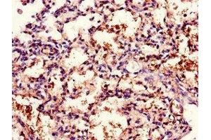 Immunohistochemistry of paraffin-embedded human lung tissue using ABIN7171408 at dilution of 1:100 (CD96 Antikörper  (AA 306-395))