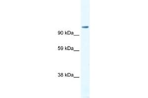 WB Suggested Anti-FOXP4 Antibody Titration:  1. (FOXP4 Antikörper  (C-Term))