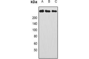 Western blot analysis of CAD expression in HepG2 (A), Hela (B), HL60 (C) whole cell lysates. (CAD Antikörper)