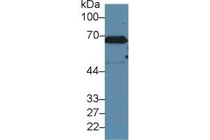 Detection of CK2 in Human A431 cell lysate using Polyclonal Antibody to Keratin 2 (CK2) (Keratin 2 Antikörper  (AA 508-685))