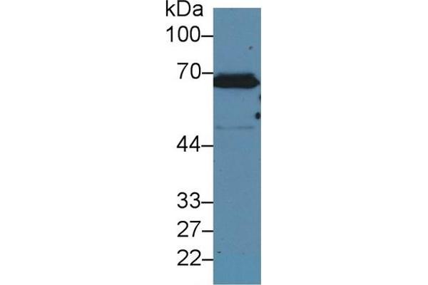 Keratin 2 Antikörper  (AA 508-685)