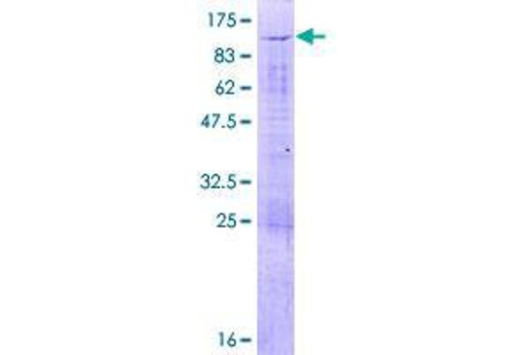 UTP3 Protein (AA 1-479) (GST tag)