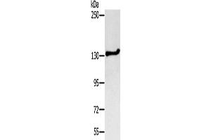Western Blotting (WB) image for anti-serologically Defined Colon Cancer Antigen 1 (SDCCAG1) antibody (ABIN2427145) (NEMF Antikörper)