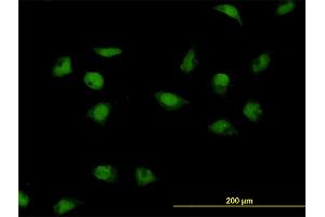 Immunofluorescence of monoclonal antibody to CNOT3 on HeLa cell. (CNOT3 Antikörper  (AA 1-100))