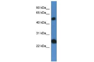 WB Suggested Anti-SLA2 Antibody Titration: 0. (SLAP2 Antikörper  (N-Term))