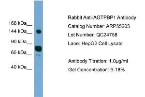 WB Suggested Anti-AGTPBP1  Antibody Titration: 0. (AGTPBP1 Antikörper  (N-Term))