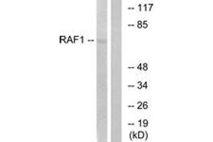 Western blot analysis of extracts from HeLa cells, treated with UV 5', using C-RAF (Ab-621) Antibody. (RAF1 Antikörper  (AA 591-640))