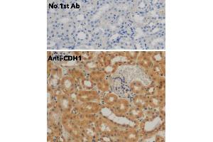 Immunohistochemistry (IHC) image for anti-Cadherin 1, Type 1, E-Cadherin (Epithelial) (CDH1) antibody (ABIN6254215) (E-cadherin Antikörper)