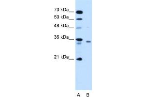 WB Suggested Anti-RCE1 Antibody Titration:  1.