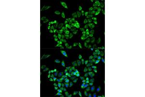 Immunofluorescence analysis of A549 cell using AOC3 antibody. (AOC3 Antikörper  (AA 27-190))