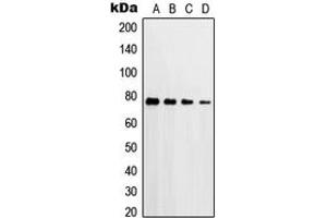 Western blot analysis of PKC delta (pT507) expression in HeLa H2O2-treated (A), A549 H2O2-treated (B), Raw264. (PKC delta Antikörper  (pSer507))