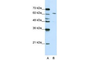 WB Suggested Anti-CPSF6 Antibody Titration:  0. (CPSF6 Antikörper  (Middle Region))