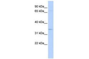 Image no. 1 for anti-CHRNA7 (Cholinergic Receptor, Nicotinic, alpha 7, Exons 5-10) and FAM7A (Family with Sequence Similarity 7A, Exons A-E) Fusion (CHRFAM7A) (AA 180-229) antibody (ABIN6740421)