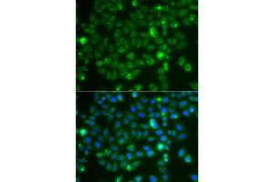 Immunofluorescence analysis of A549 cells using RAC1 antibody. (RAC1 Antikörper)