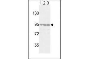 Western blot analysis of DDR2 antibody in Jurkat (lane 1), 293 (2) and HeLa (3) lysate. (DDR2 Antikörper)