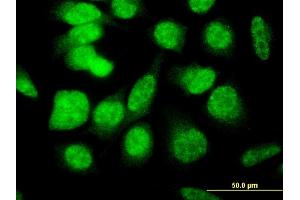 Immunofluorescence of monoclonal antibody to E4F1 on HeLa cell.