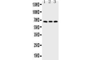 Anti-CD30 Picoband antibody, All lanes: Anti-CD30 at 0. (TNFRSF8 Antikörper  (AA 322-595))