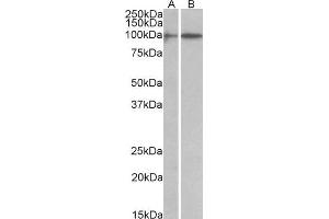 ABIN1590055 (1 µg/mL) staining of A549 (A) and Jurkat (B) lysates (35 µg protein in RIPA buffer).