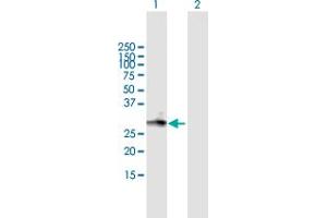 Western Blot analysis of MGC3036 expression in transfected 293T cell line by MGC3036 MaxPab polyclonal antibody. (LRRC61 Antikörper  (AA 1-259))